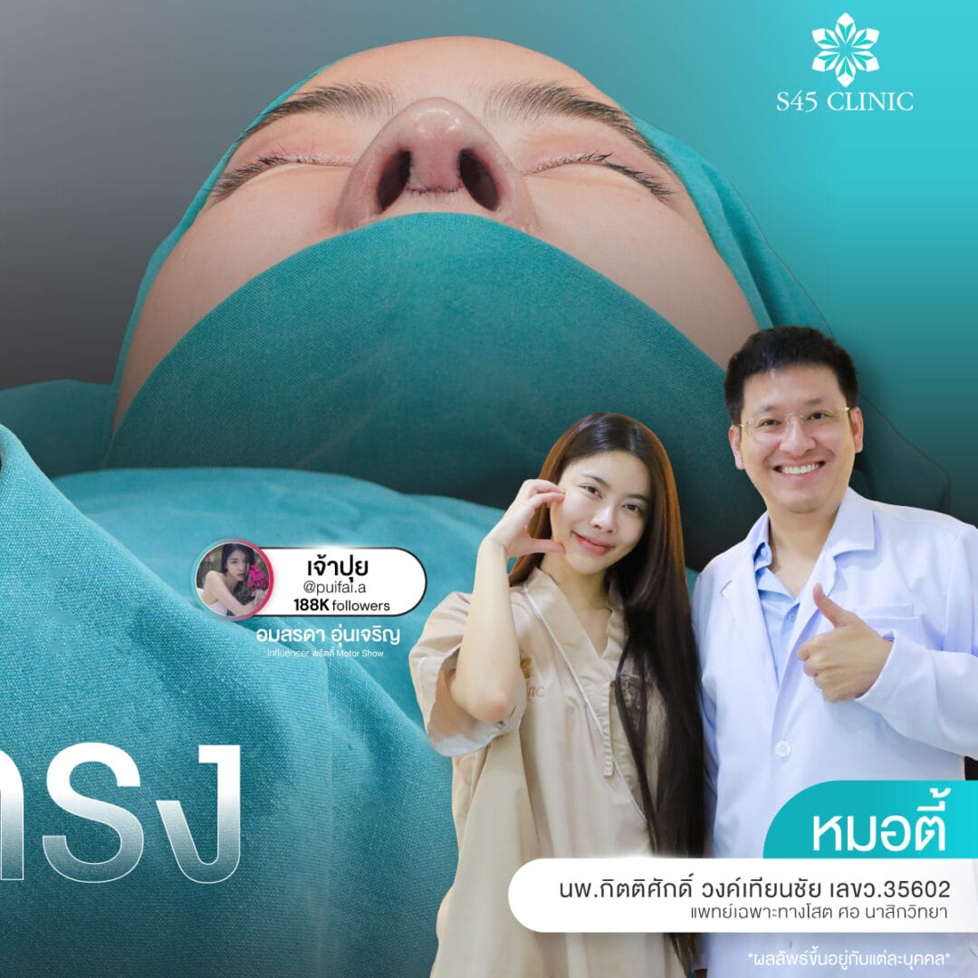 แก้จมูก หดรั้ง หมอตี้ S45 Original