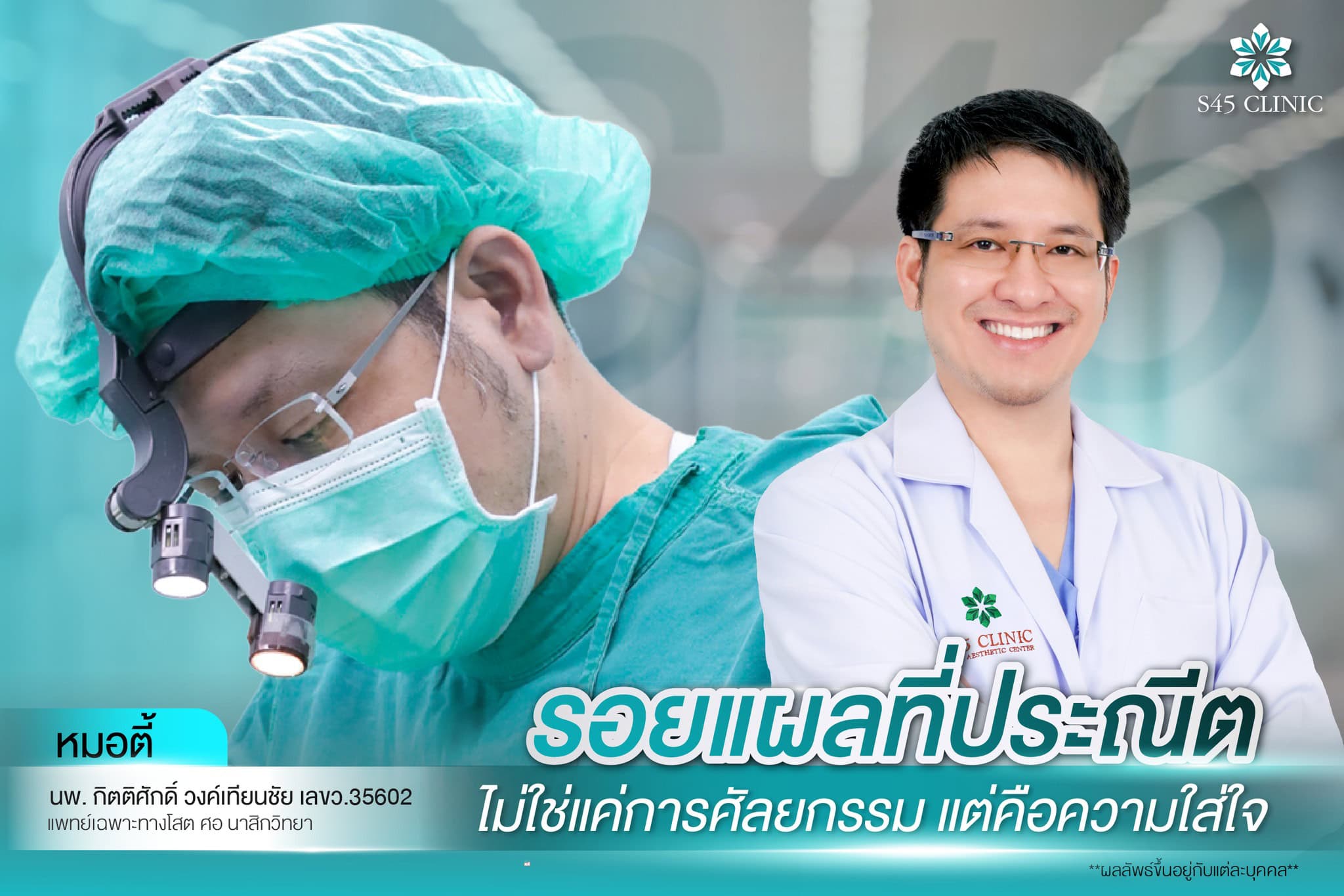 แก้จมูก หดรั้ง หมอตี้ S45 Original