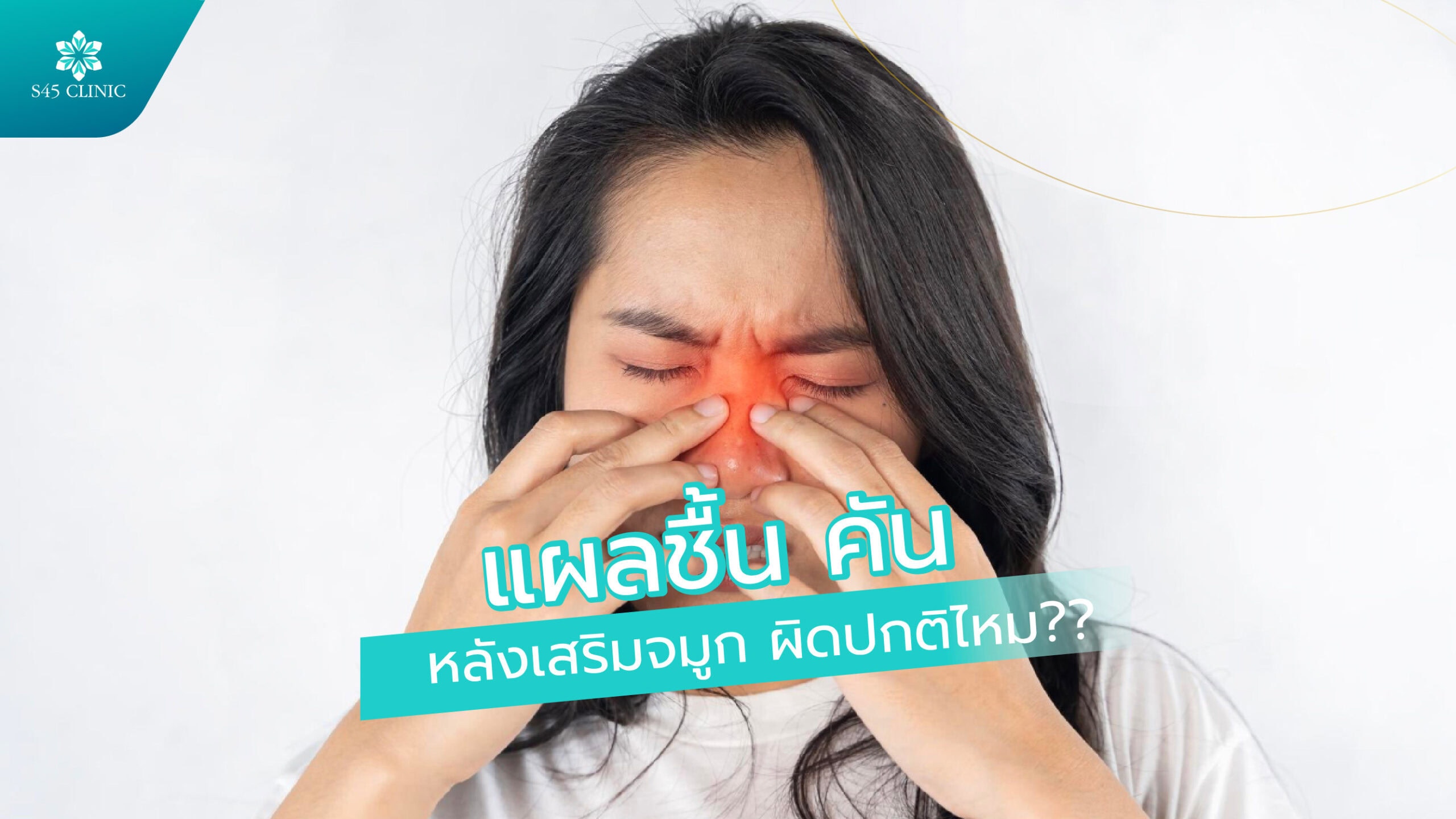 แผลแฉะ หลังเสริมจมูก