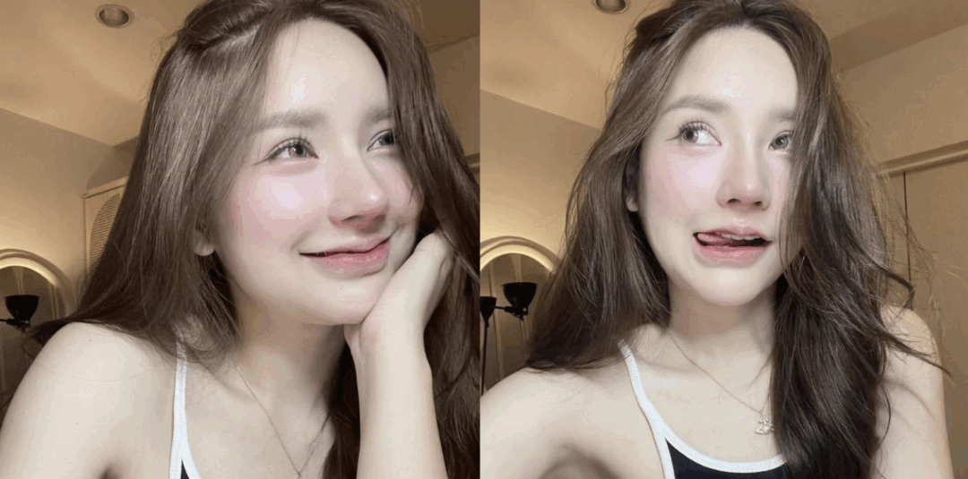 แก้จมูก แกนเอียง รูจมูกไม่เท่ากัน