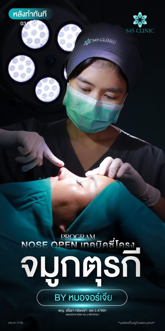 จมูกตุรกี หมอจอร์เจีย