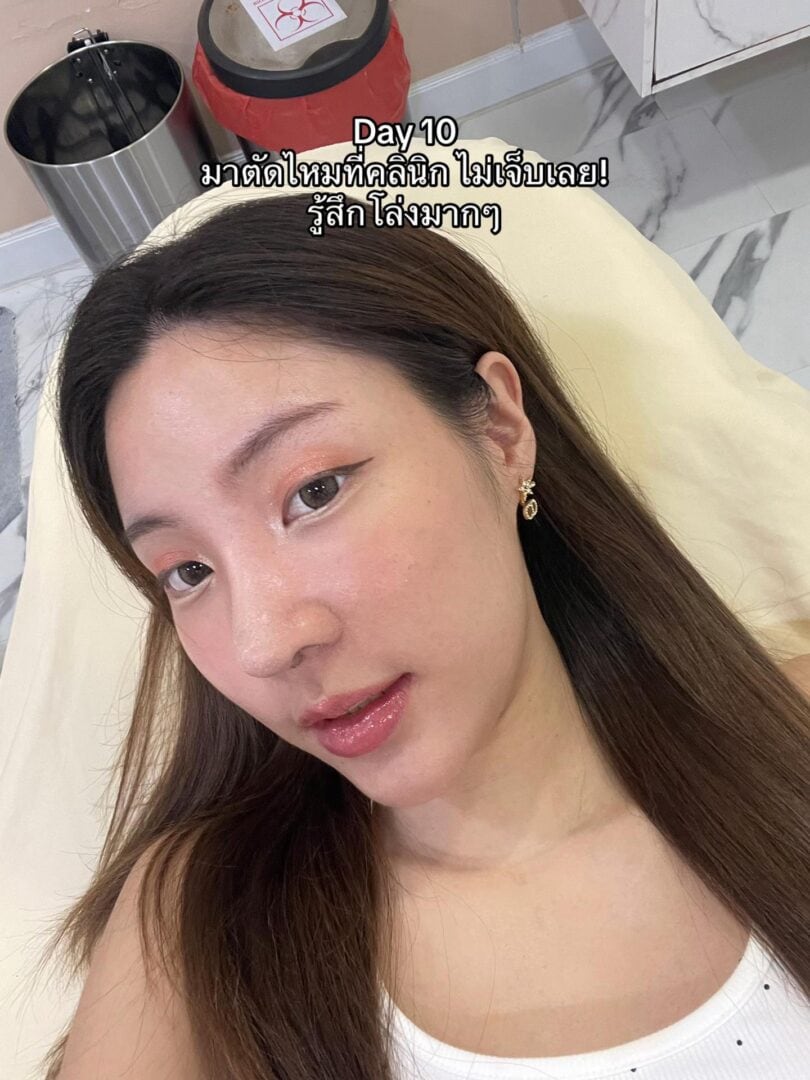 ทรงจมูก RosyNose