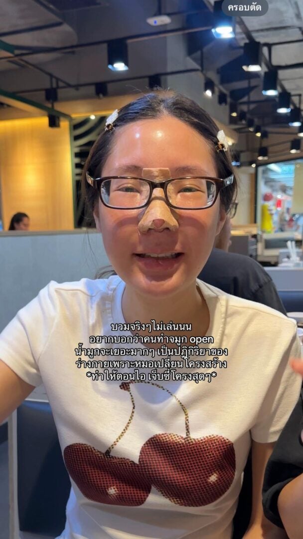 ทรงจมูก RosyNose