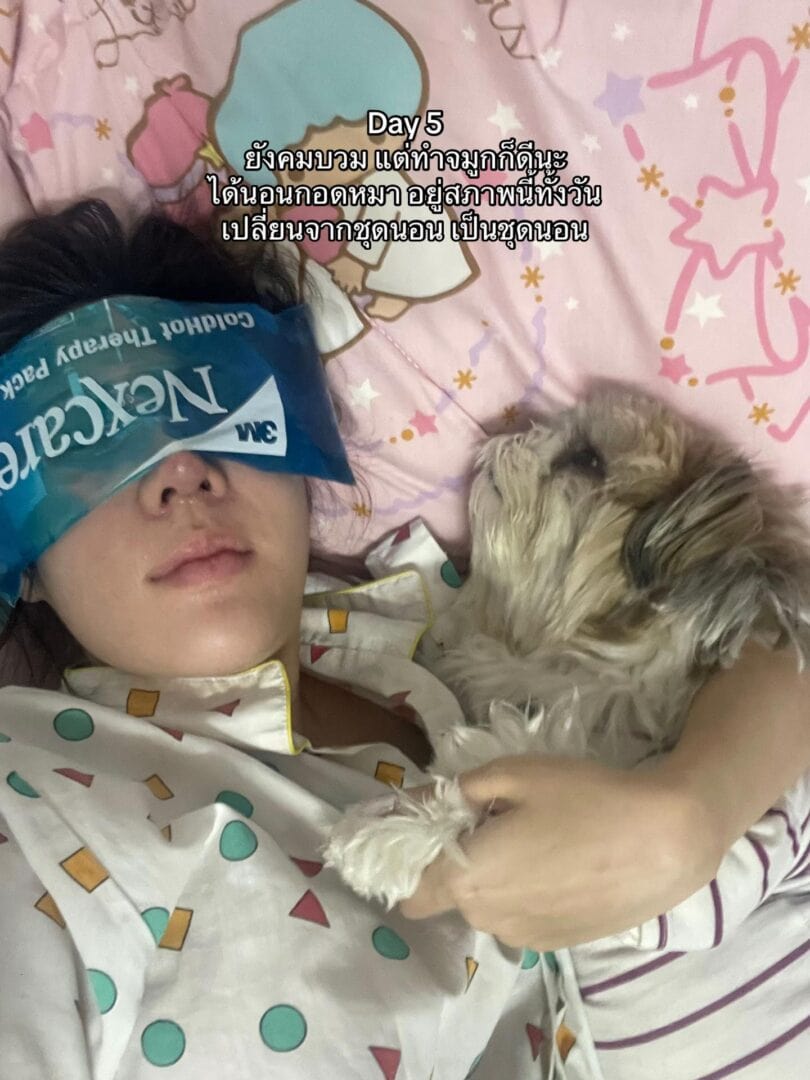 ทรงจมูก RosyNose