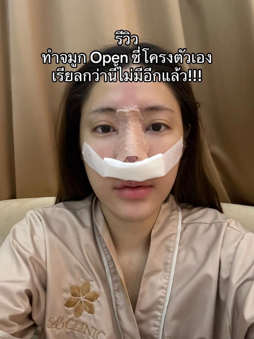 ทรงจมูก RosyNose