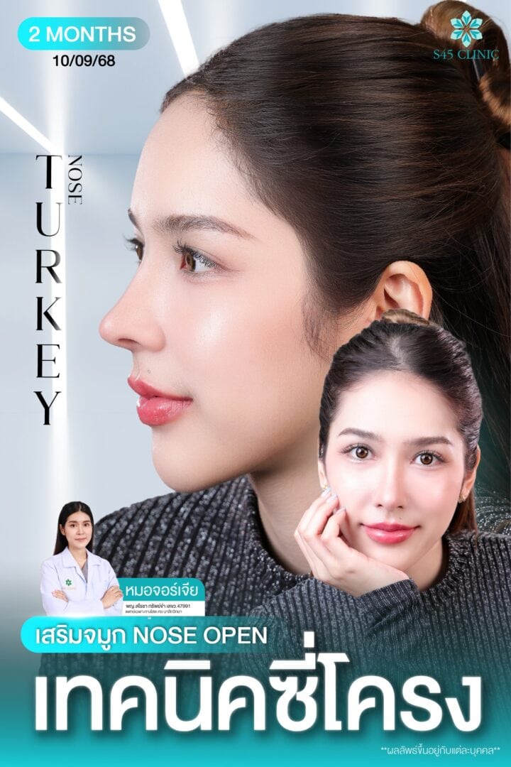 ทรงจมูกตุรกี หมอจอร์เจีย