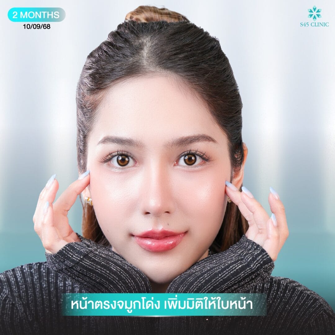 ทรงจมูกตุรกี หมอจอร์เจีย