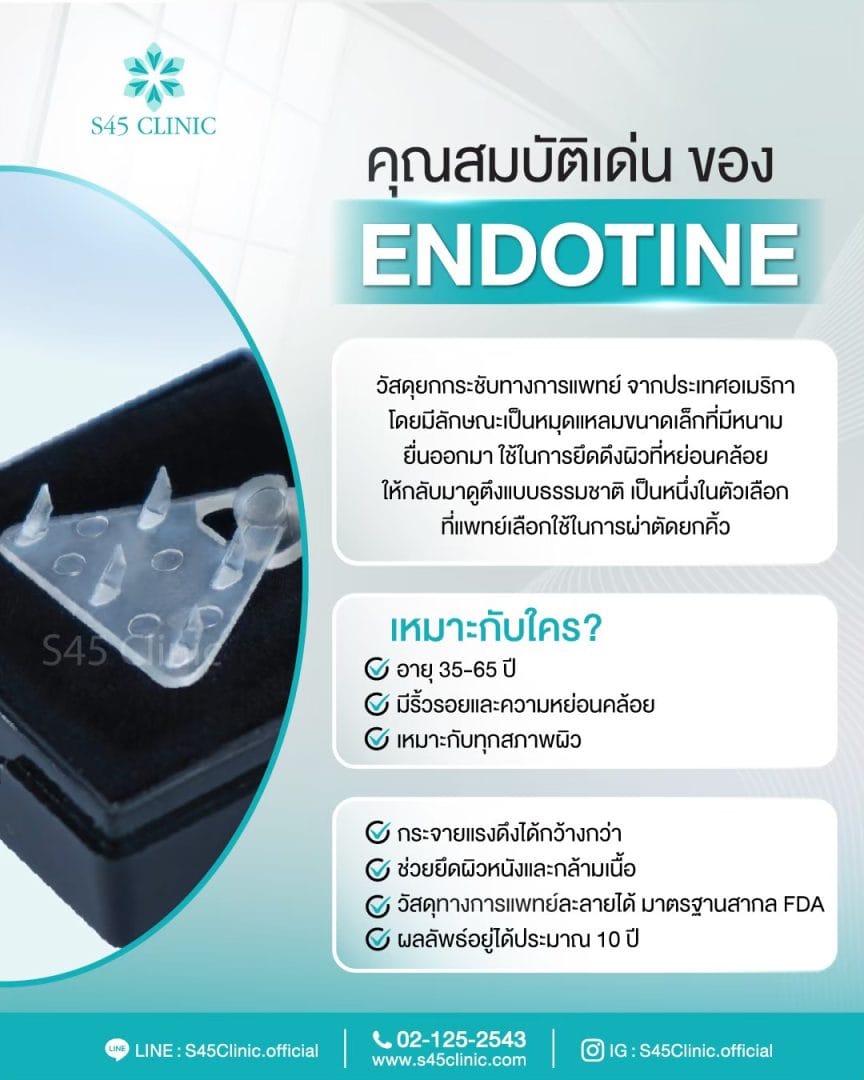 Endotine ยกคิ้ว ส่องกล้อง