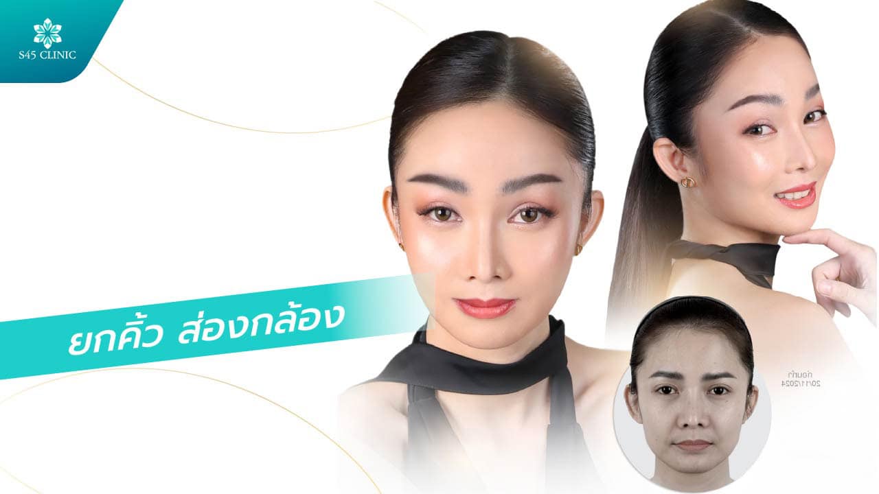 ยกคิ้ว ส่องกล้อง