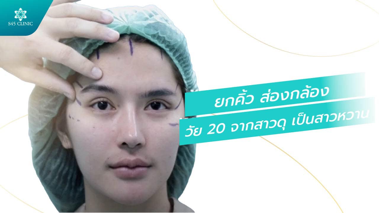 ยกคิ้ว ส่องกล้อง