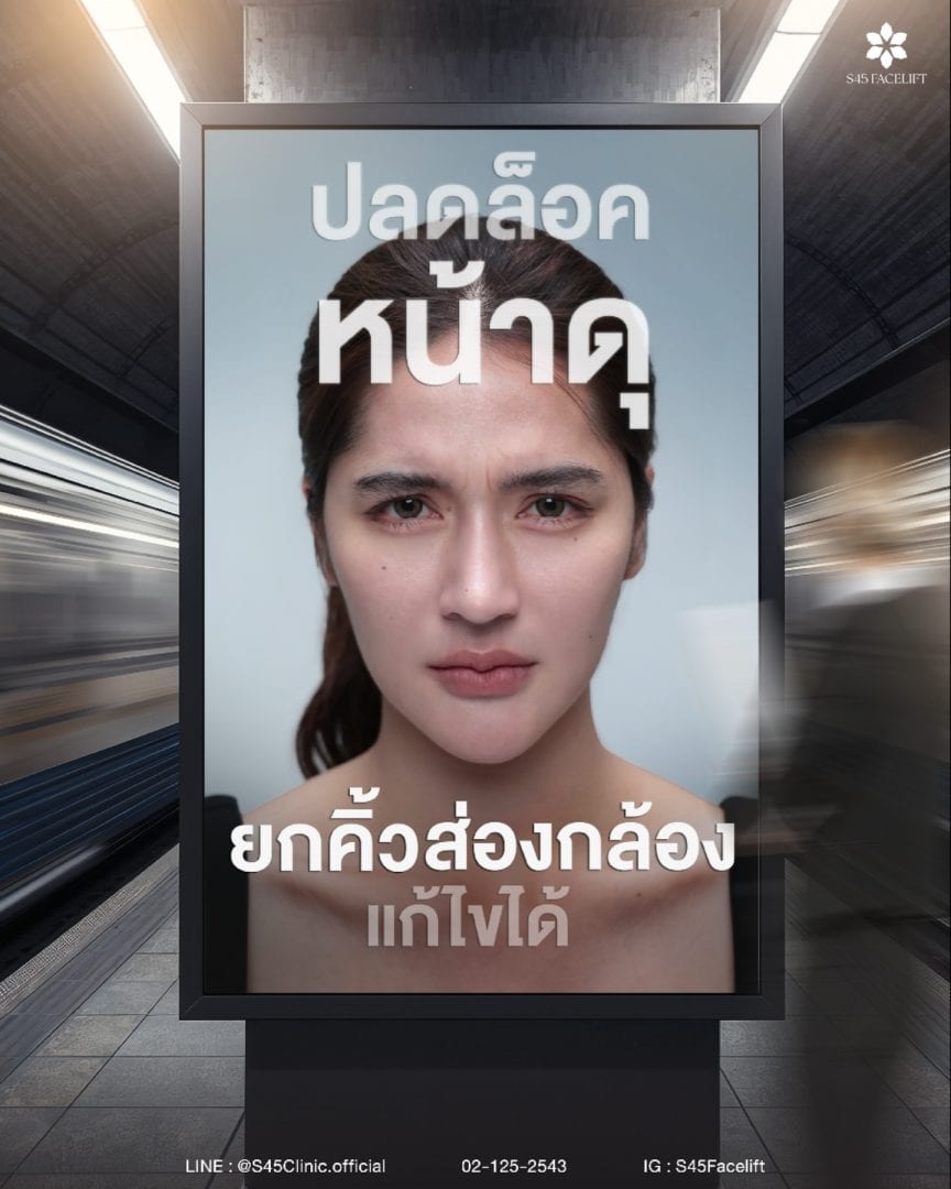 ยกคิ้ว ส่องกล้อง