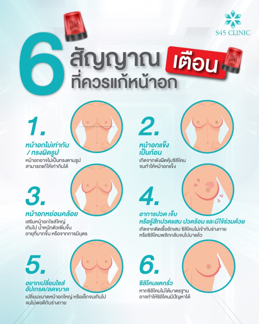 เหตุผลที่ต้องแก้ทรงหน้าอก หลังจากเสริมหน้าอกมา 10 ปี 8 เสริมหน้าอก เสริมหน้าอก S45 Clinic