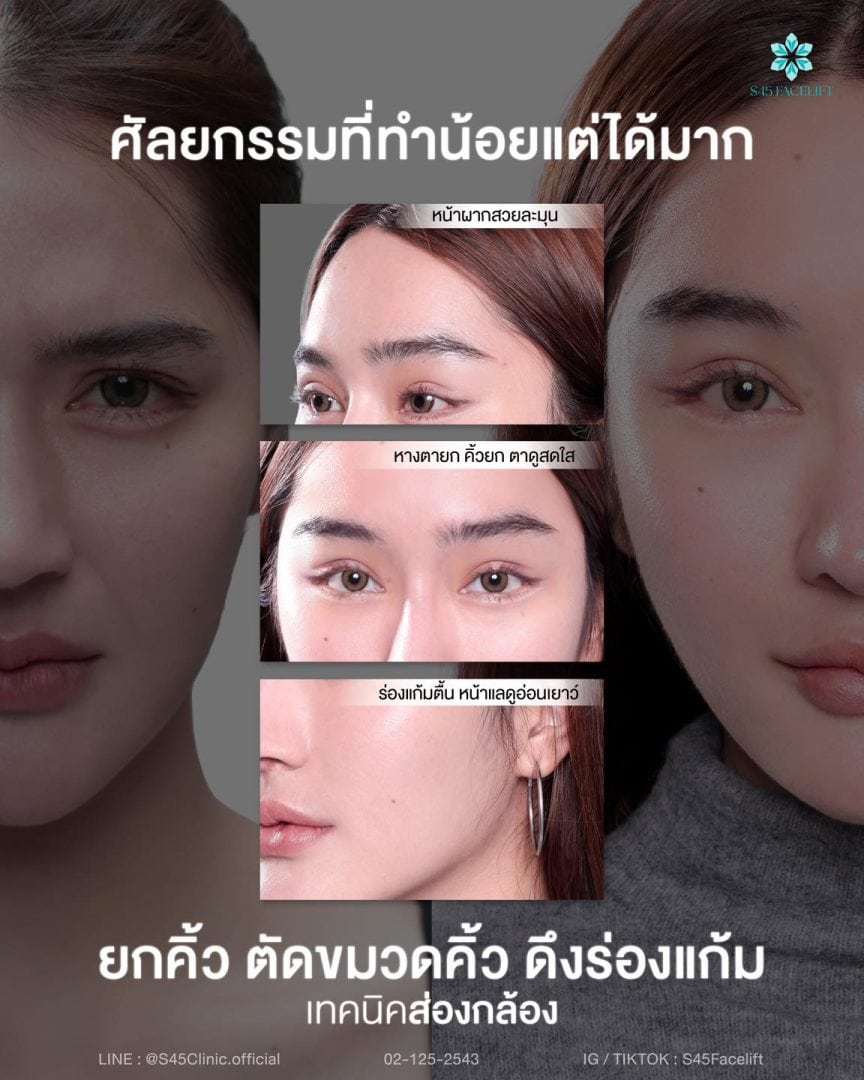 ยกคิ้ว ส่องกล้อง