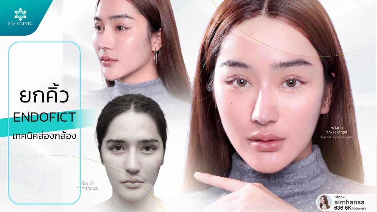 ยกคิ้ว ส่องกล้อง