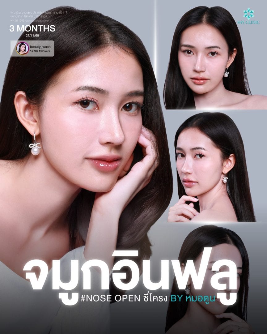 ทรงจมูก ICONIC