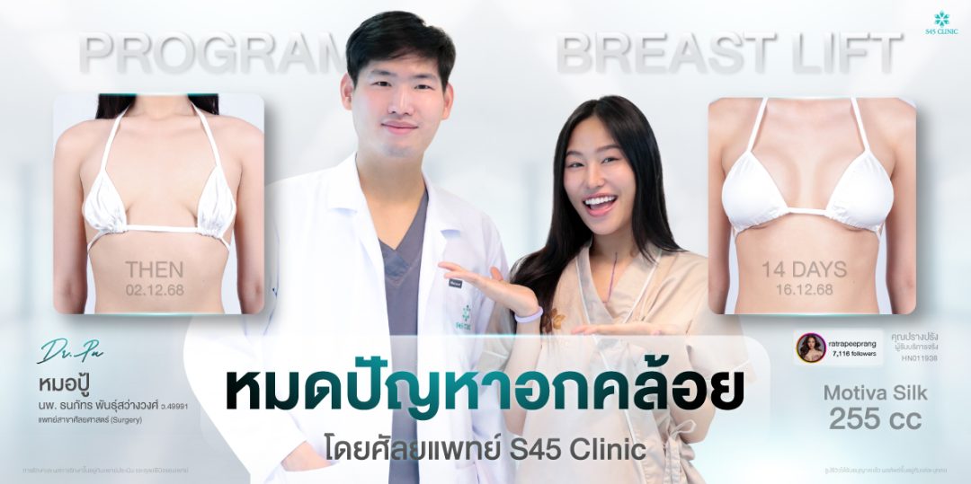 หน้าอกหย่อนคล้อย