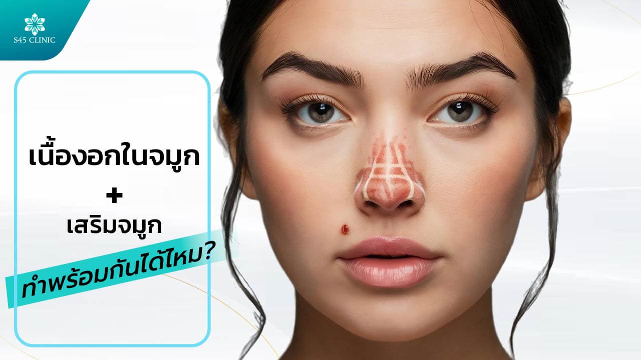 เสริมจมูก