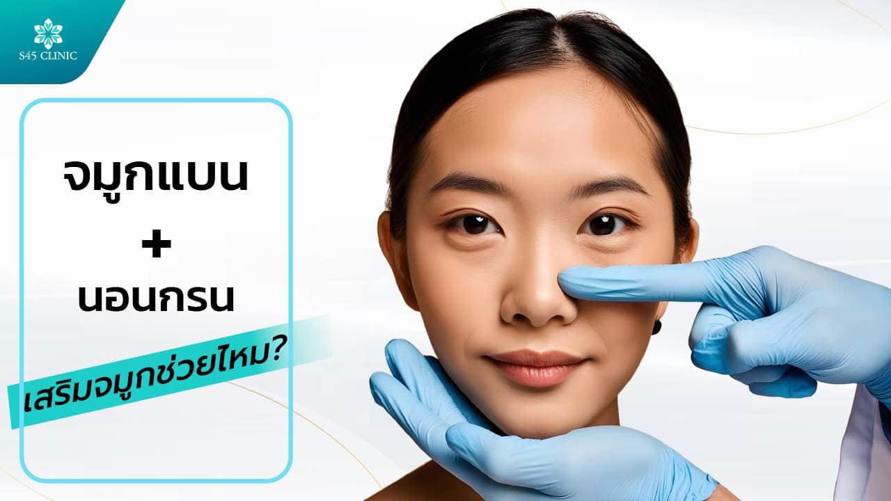 เสริมจมูก นอนกรน