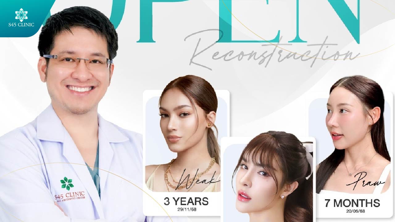 เสริมจมูก