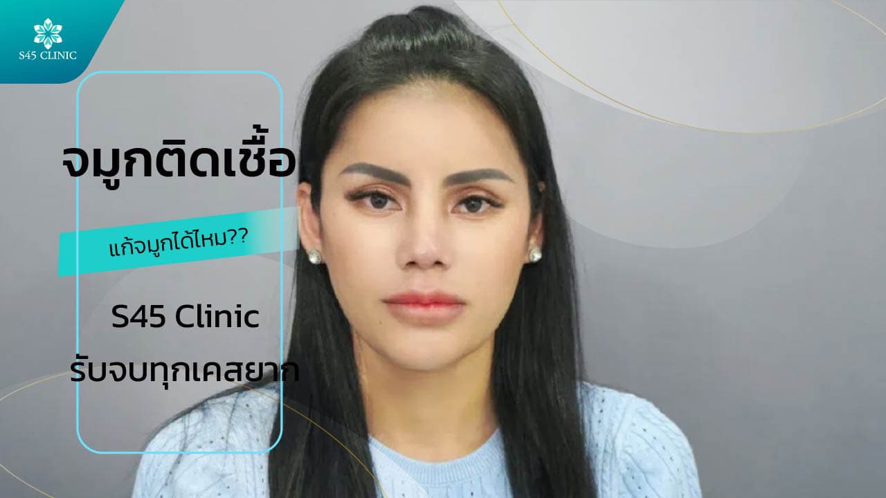 แก้จมูก จมูกติดเชื้อ