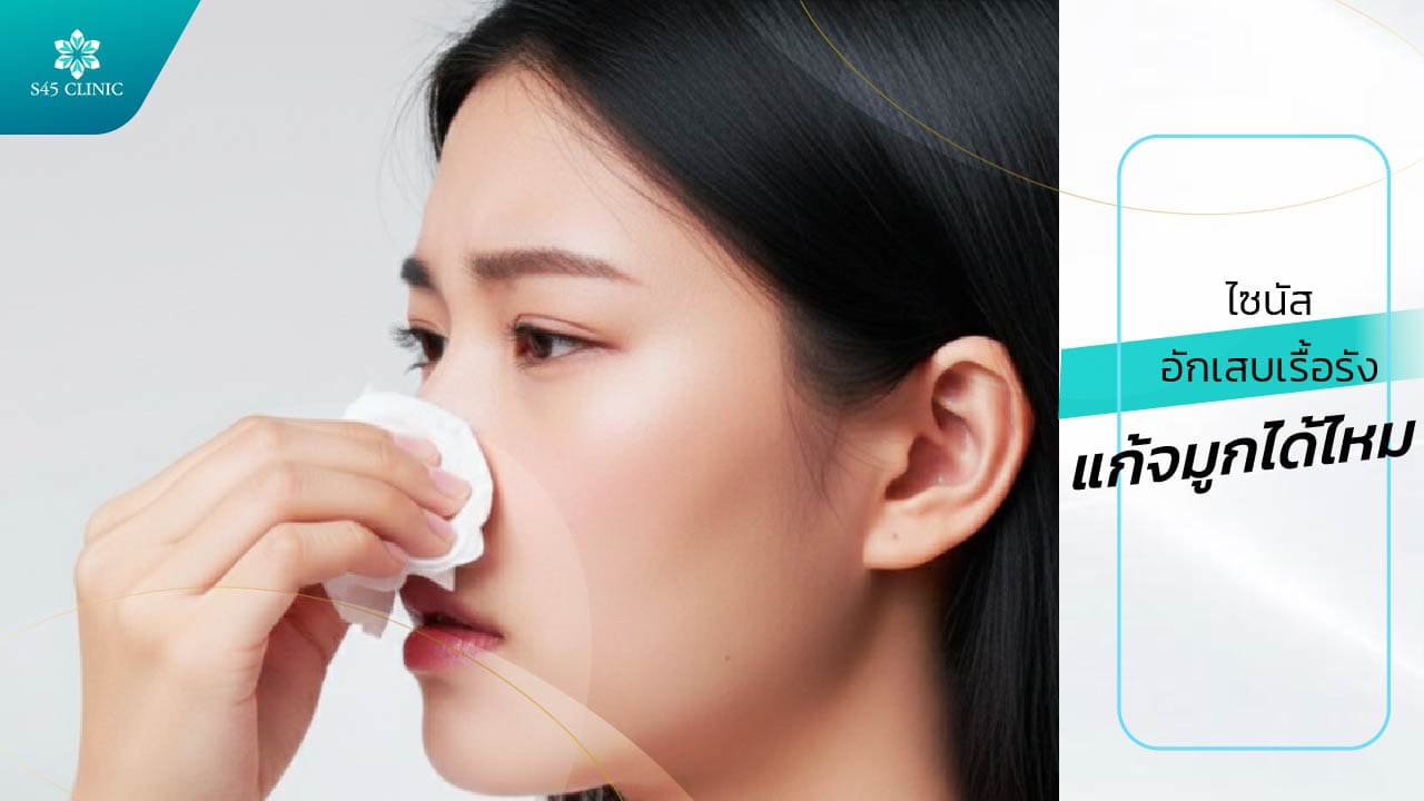 ไซนัสอักเสบเรื้อรัง