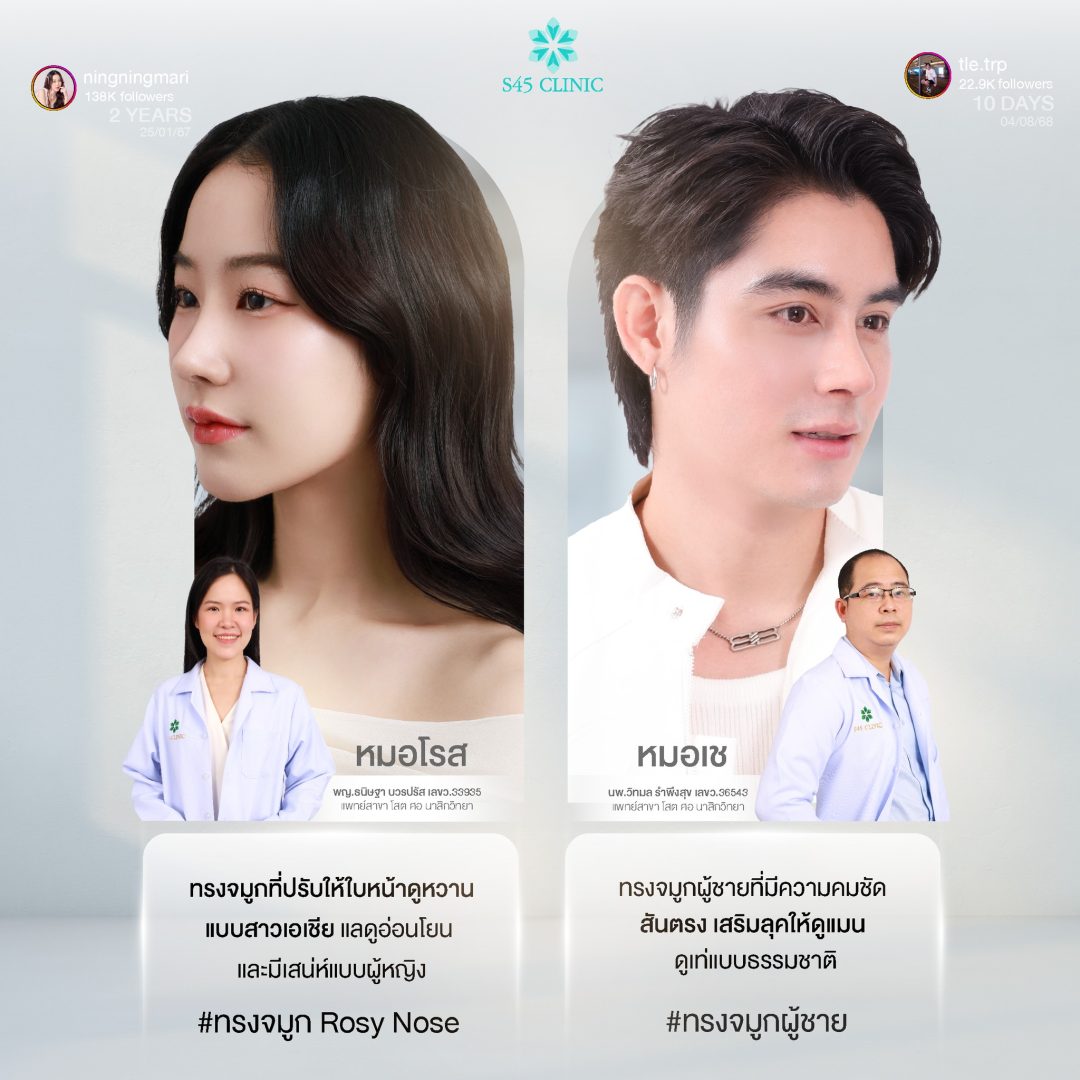 ทรงจมูก s45 clinic