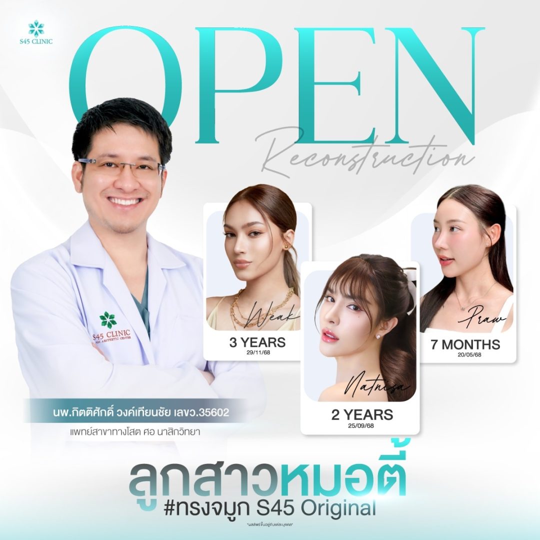 ลูกสาวหมอตี้