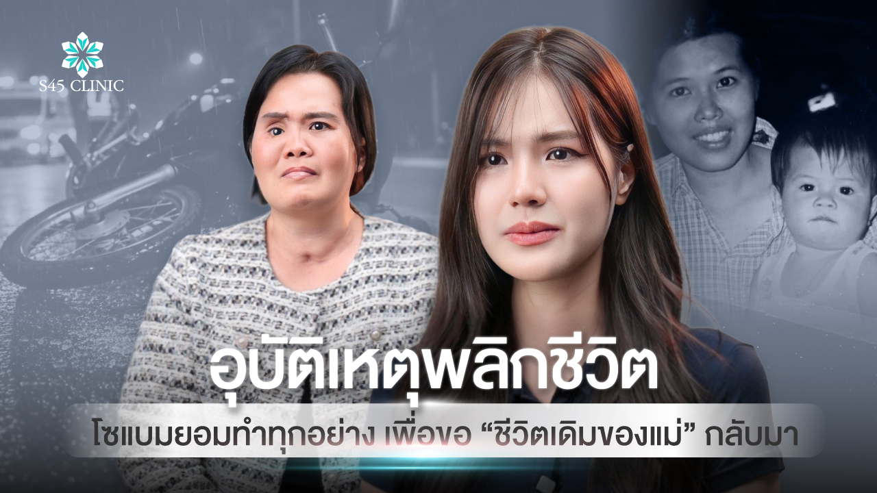 facial-reconstruction-after-accident