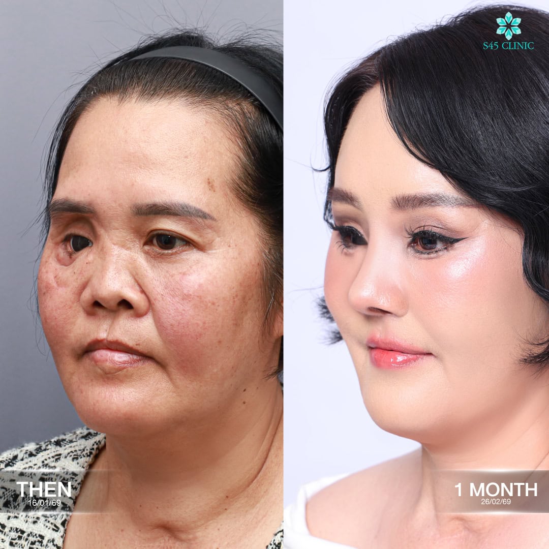 คุณแม่แดง S45 Clinic 05