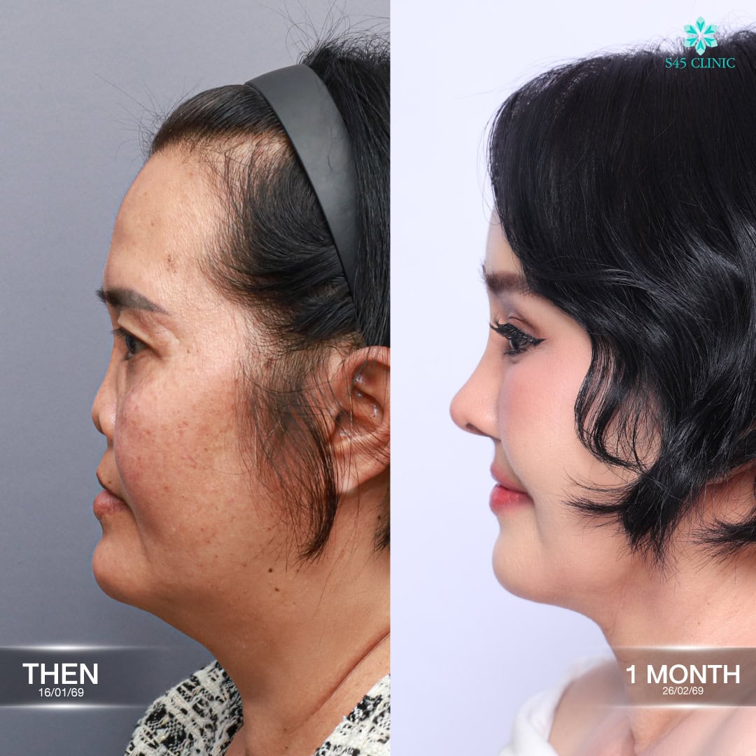 คุณแม่แดง S45 Clinic 06