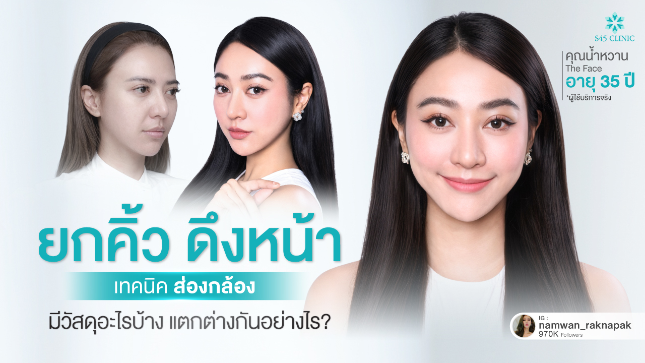 eyebrow-lift-endoscopic-technique-types-materials-s45-clinic