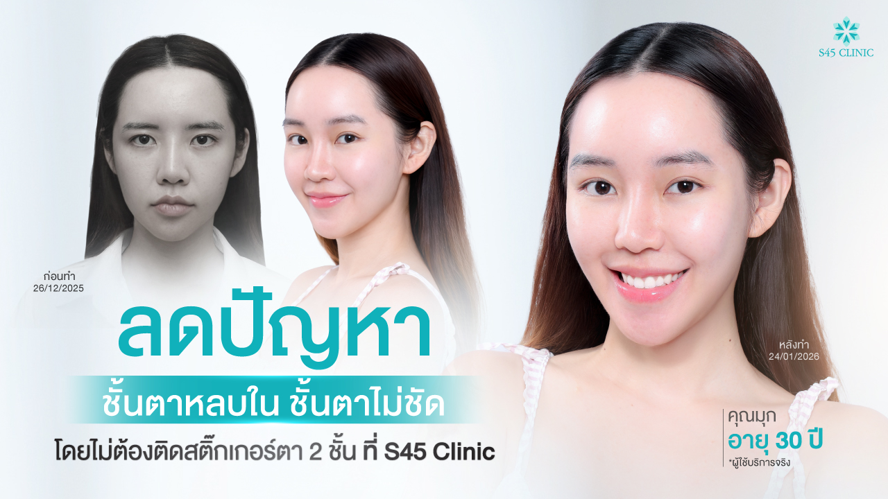 fix-hidden-eyelid-brow-lift-endoscopic-s45-clinic