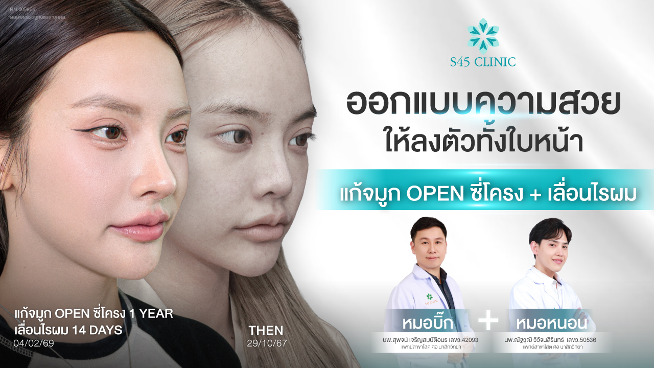 httpss45clinic.comopen-rib-rhinoplasty-hairline-lowering-s45clinic