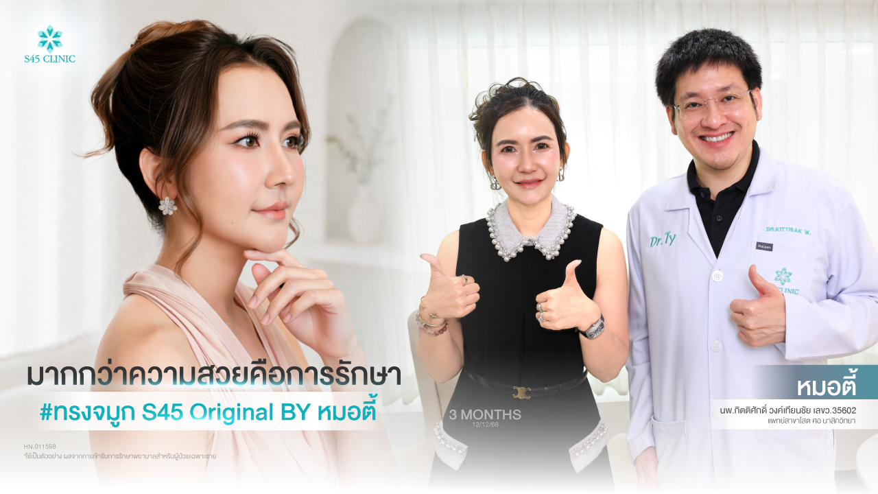 rib-open-rhinoplasty-sinus-deviated-septum-s45-clinic