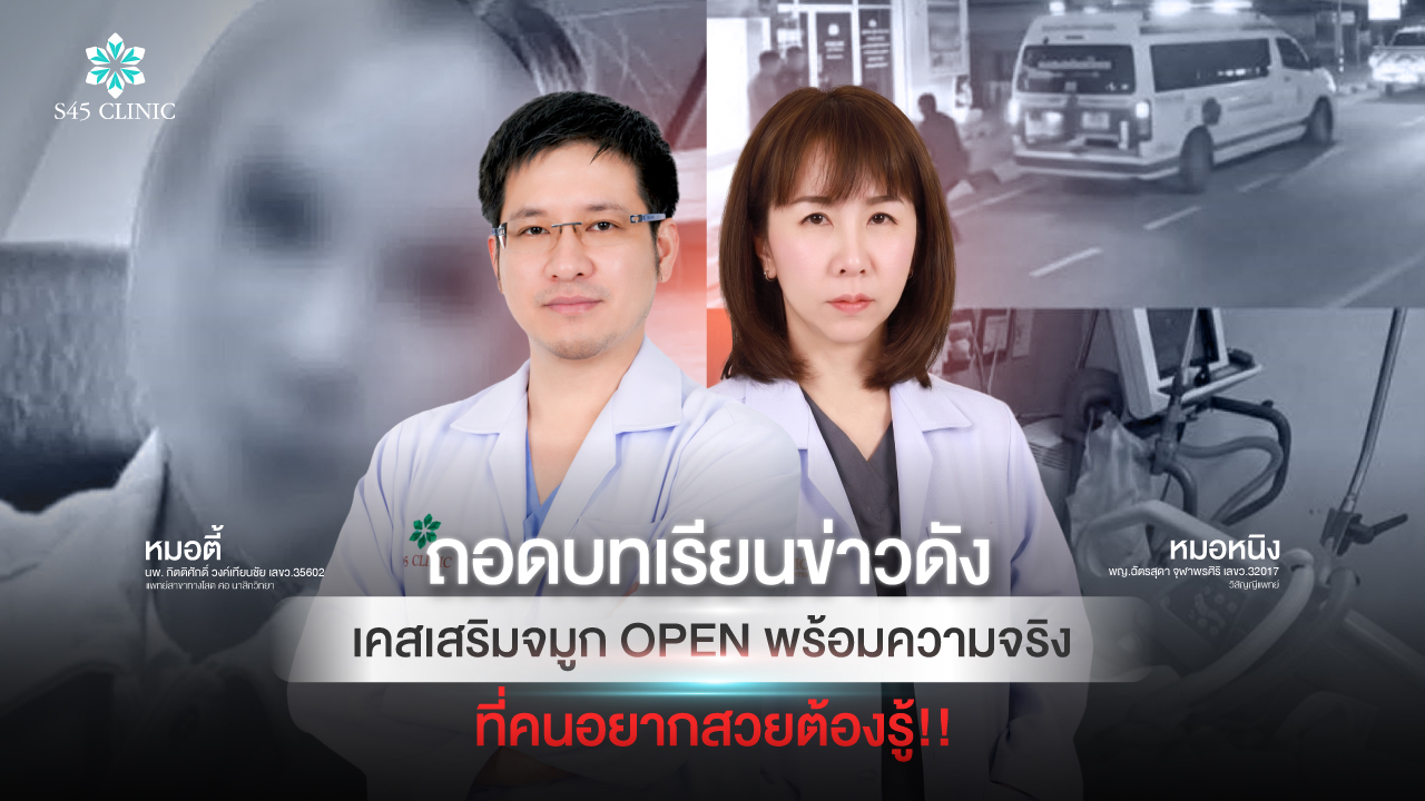 open-rhinoplasty-rib-cartilage-safety-anesthesia-risks-s45-clinic
