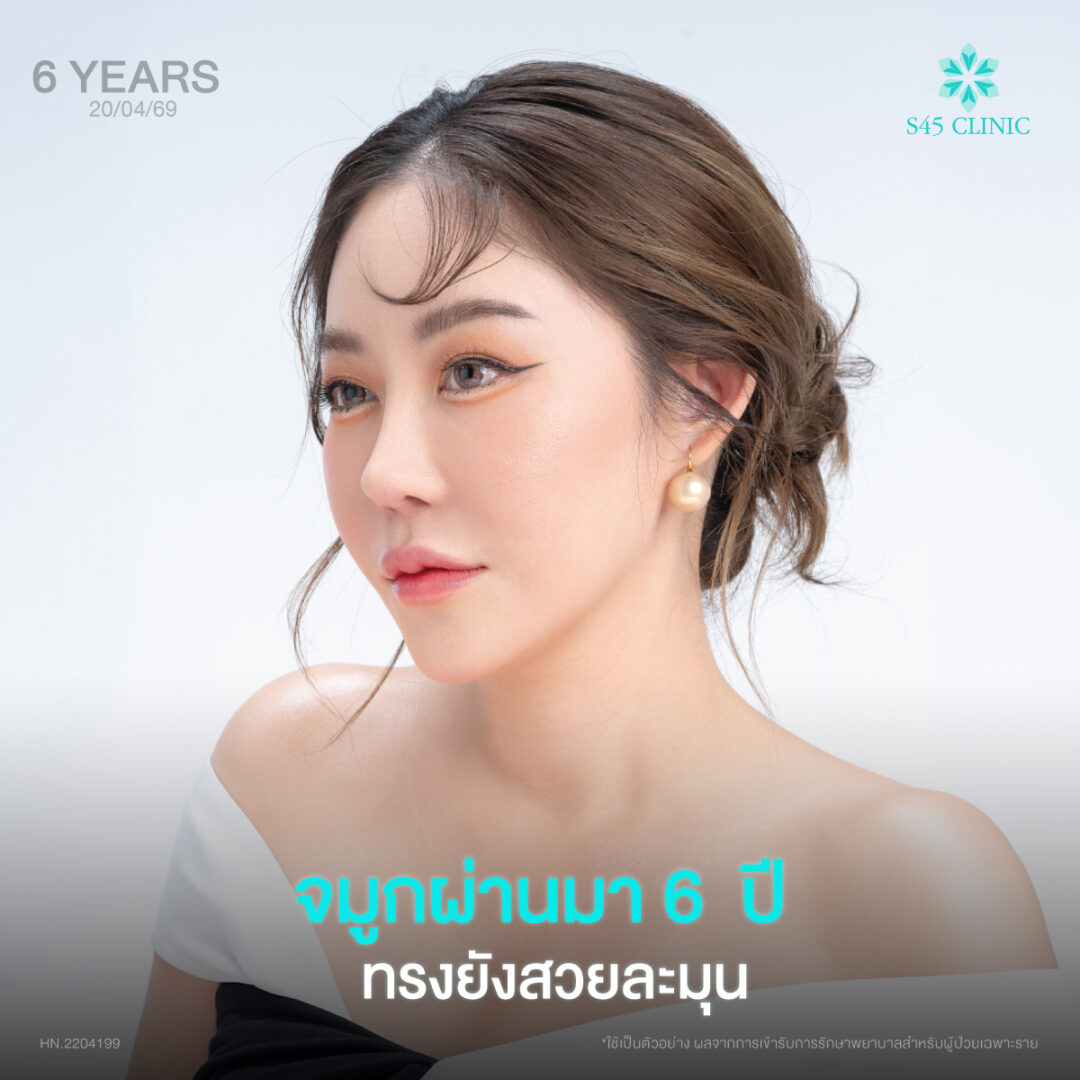 ทรงจมูก 6 ปี