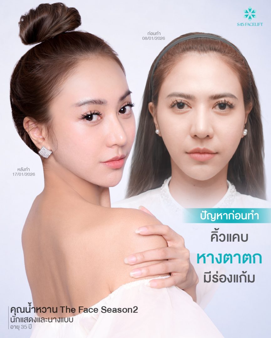 ยกคิ้ว คุณน้ำหวาน 03