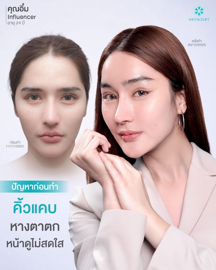 ยกคิ้ว คุณอิ๋ม 02