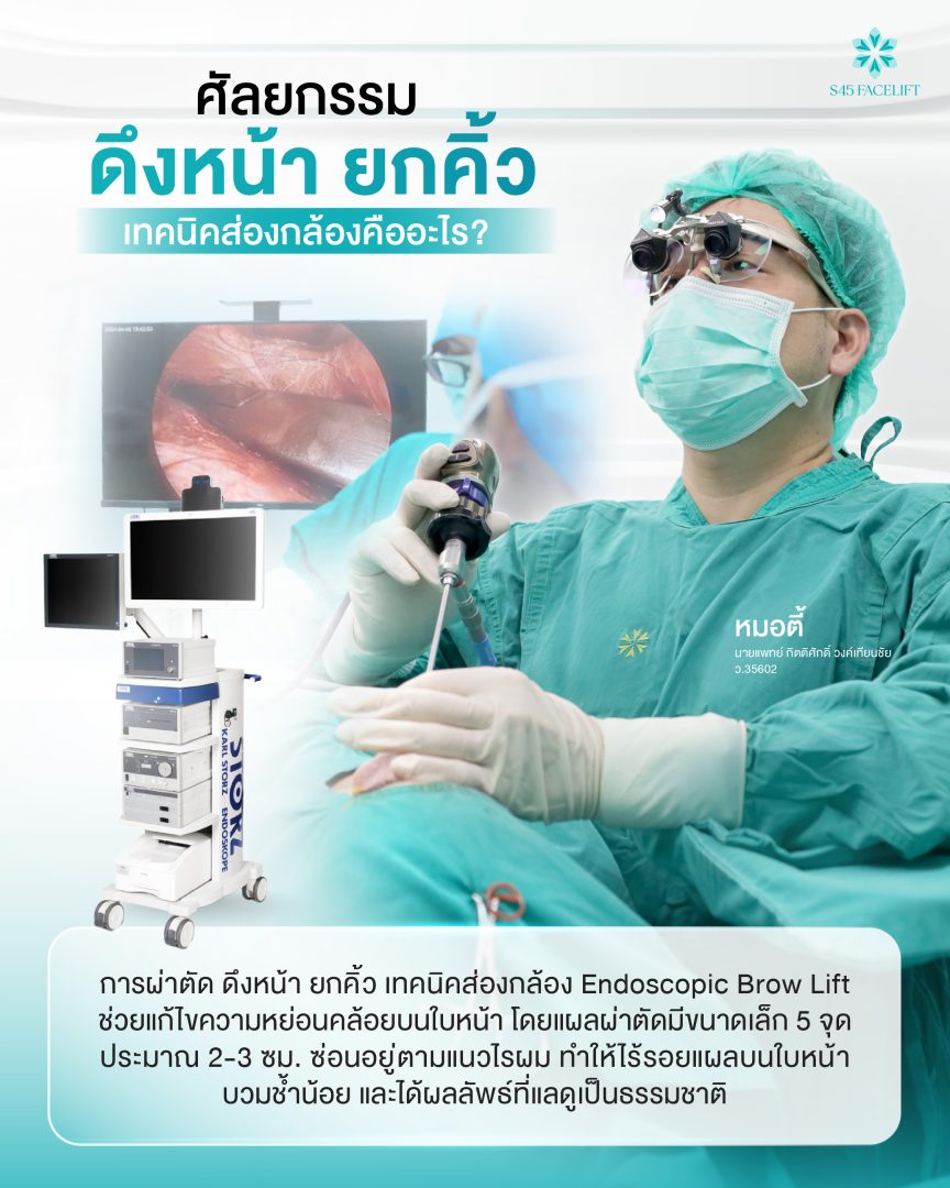 ยกคิ้ว ดึงหน้า เทคนิคส่องกล้อง 02