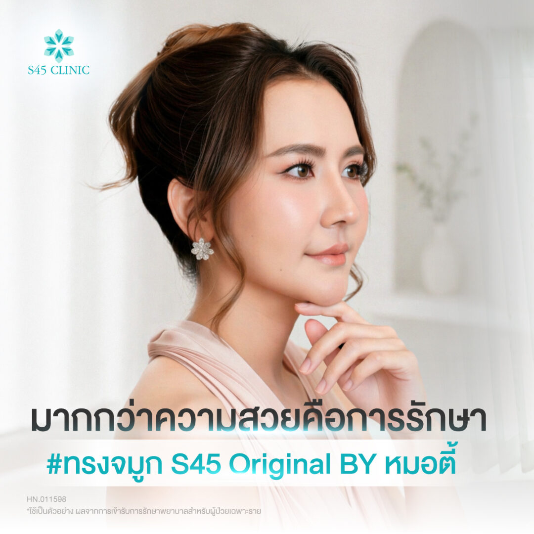 เสริมจมูก Open ซี่โครง พร้อมดูแลไซนัสและผนังจมูกคด 6 แก้จมูก หมอตี้ S45 01