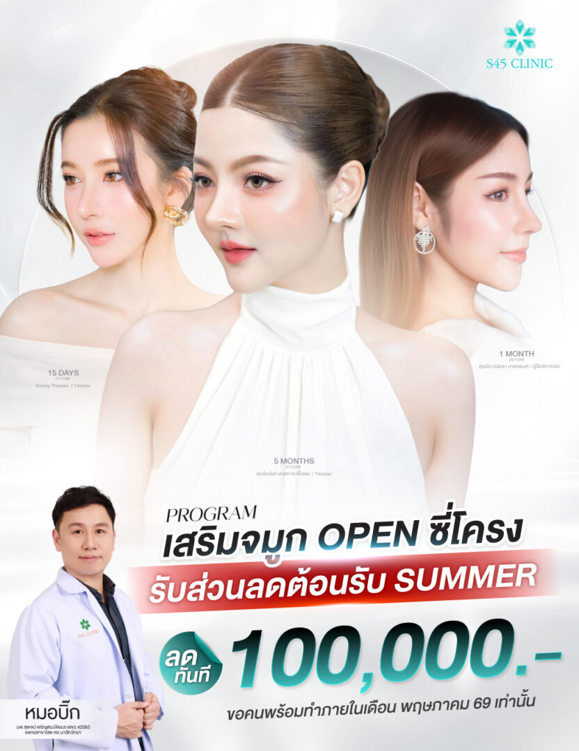 Promotion โปรโมชั่น เสริมจมูก แก้จมูก ราคาคุ้มค่า S45 Clinic จัดโปรให้ 4 โปรโมชั่น เสริมจมูก 1