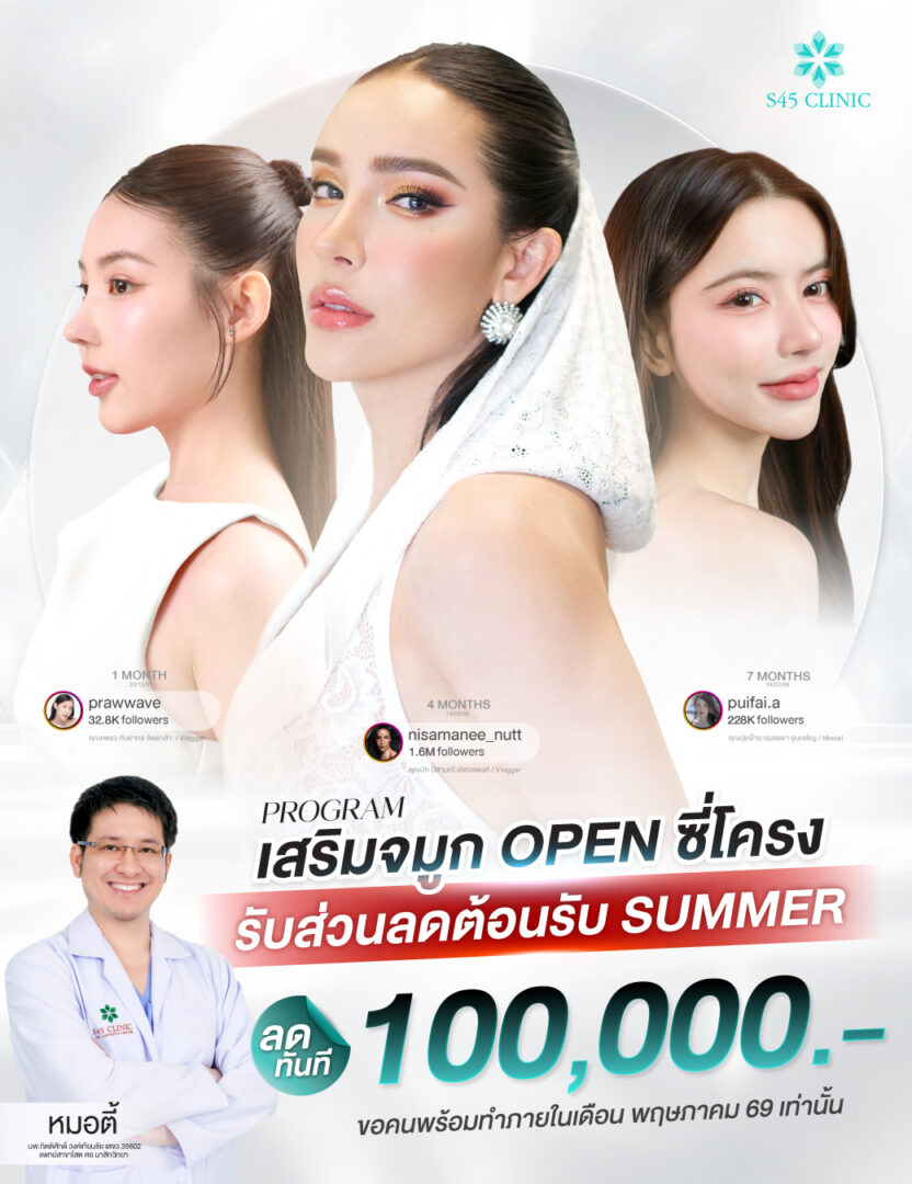 Promotion โปรโมชั่น เสริมจมูก แก้จมูก ราคาคุ้มค่า S45 Clinic จัดโปรให้ 3 โปรโมชั่น เสริมจมูก