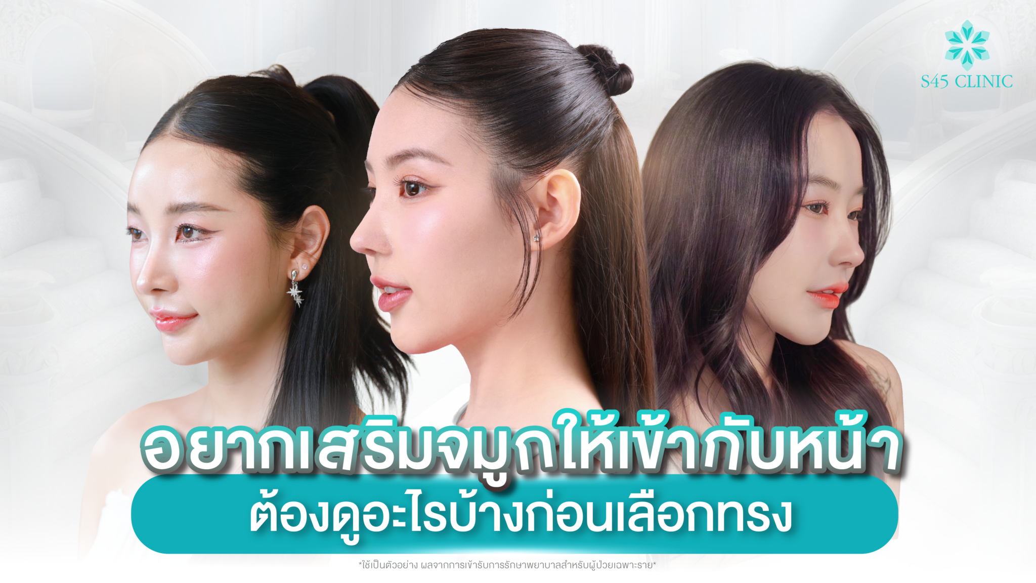 choose-nose-shape-that-fits-your-face-s45-clinic