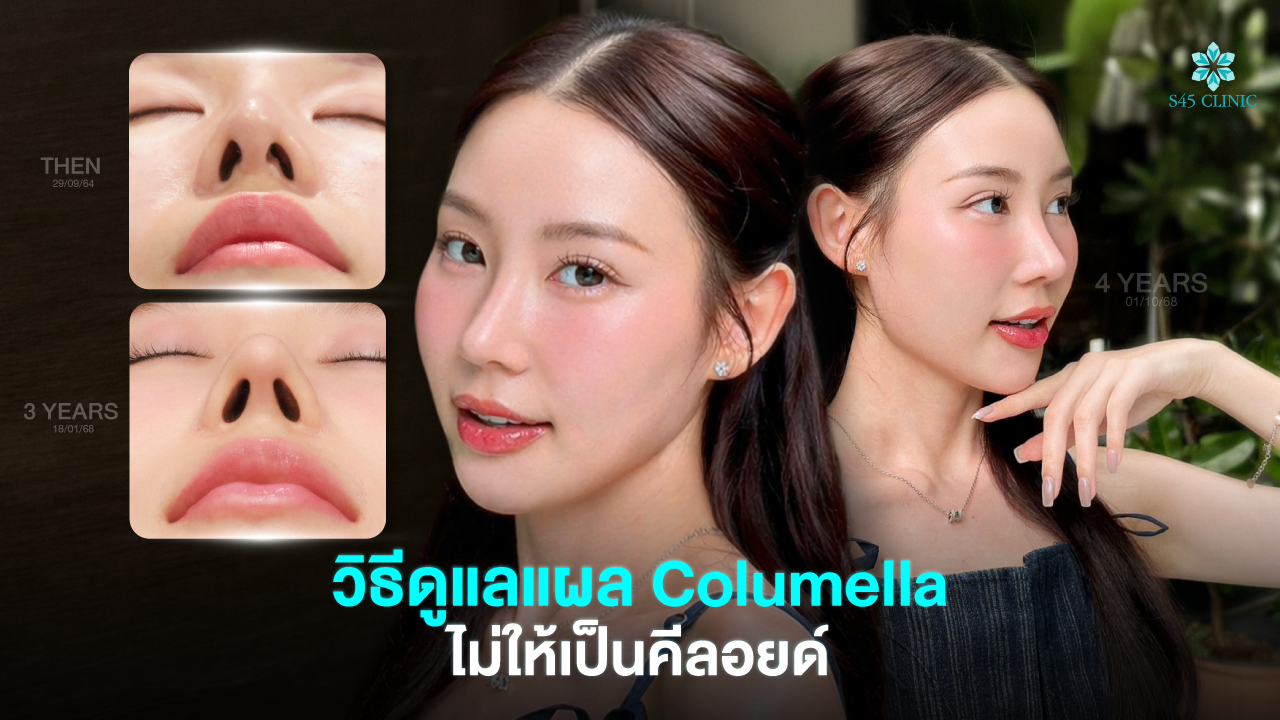 columella-scar-care-after-open-rhinoplasty