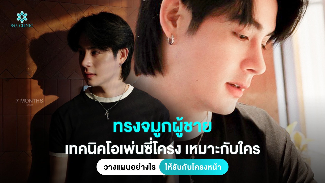 male-rhinoplasty-nose-shape-open-rib