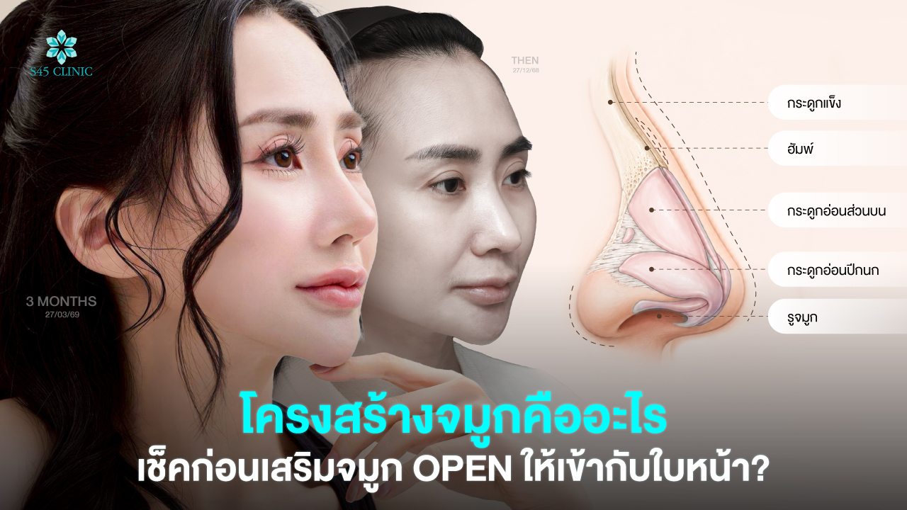nose-structure-before-open-rhinoplasty