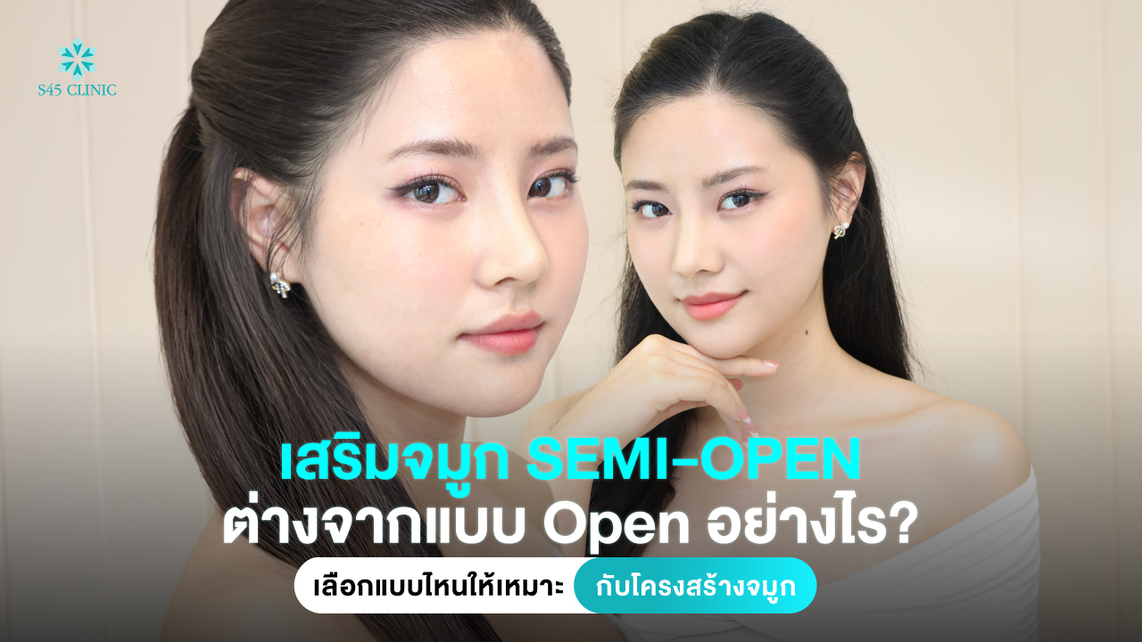 semi-open-vs-open-rhinoplasty