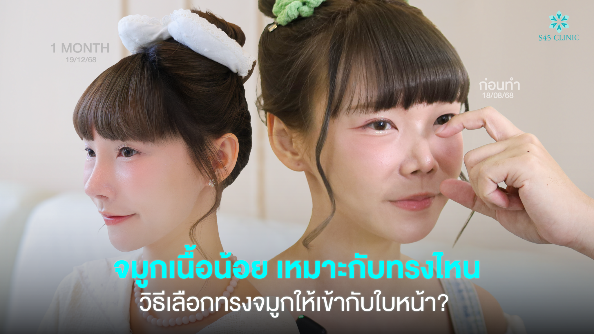 thin-nasal-skin-nose-shape