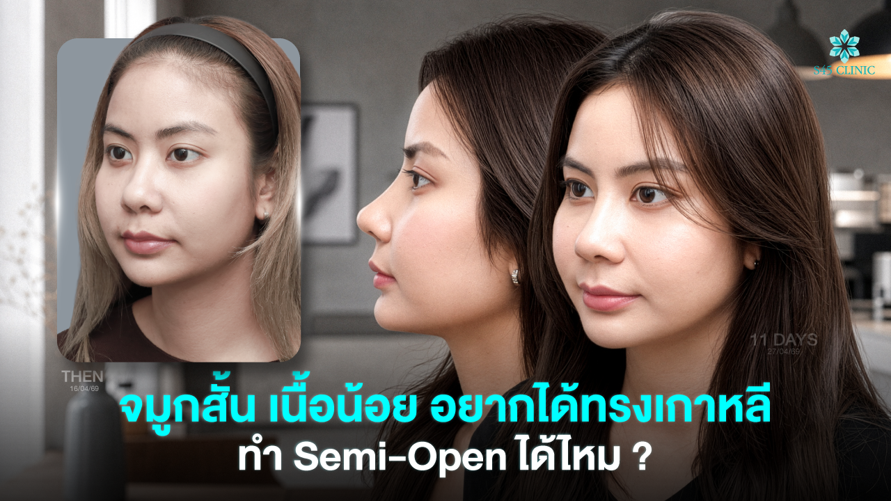 thin-nose-short-nose-semi-open-korean-style