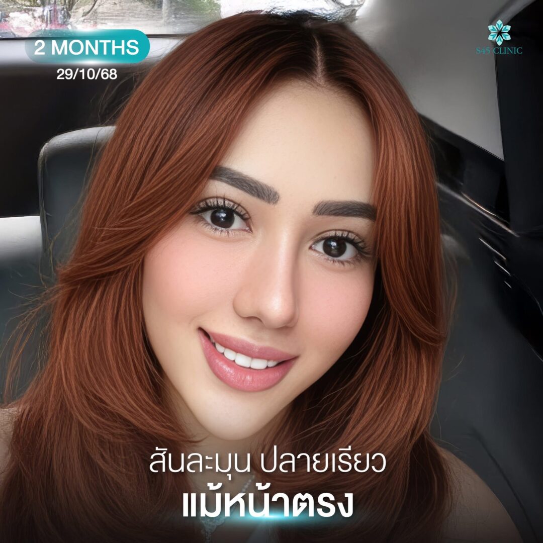จมูกสวย